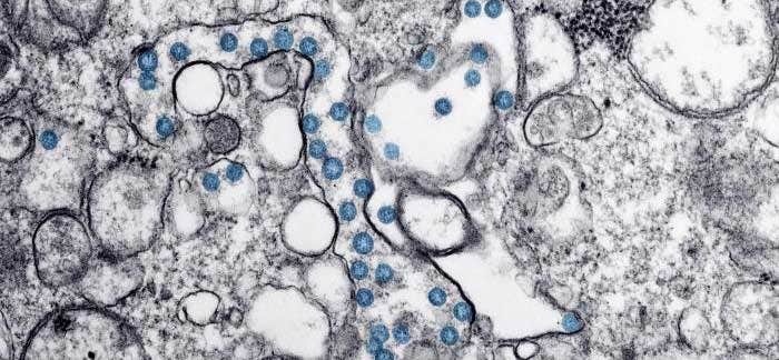 Coronavirus